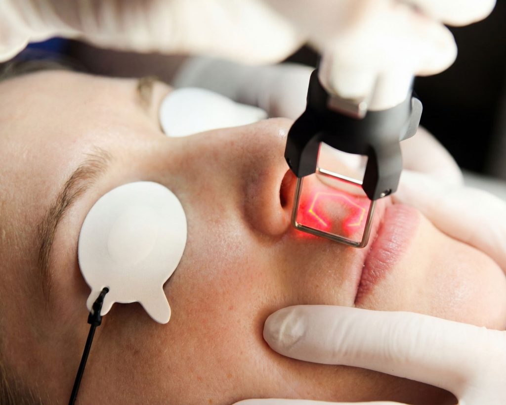 CoolPeel
