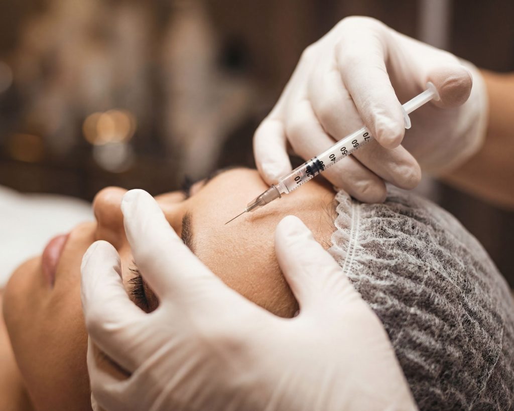 Sculptra treatment