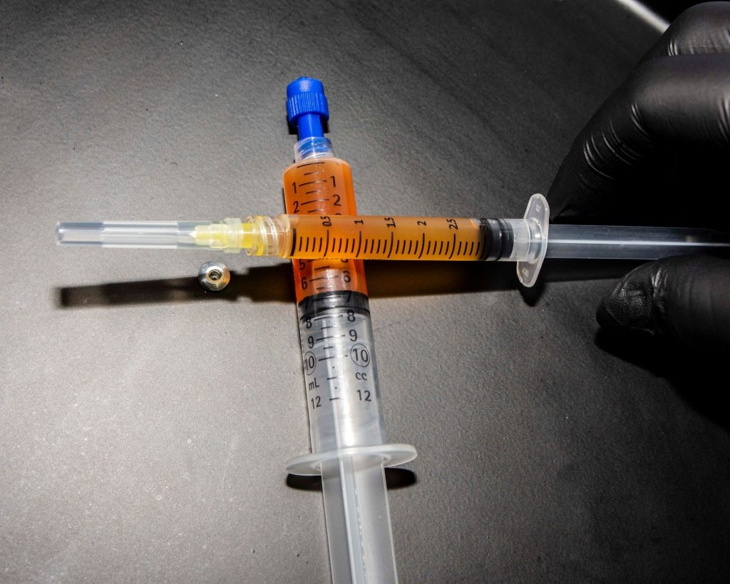 PRP treatment