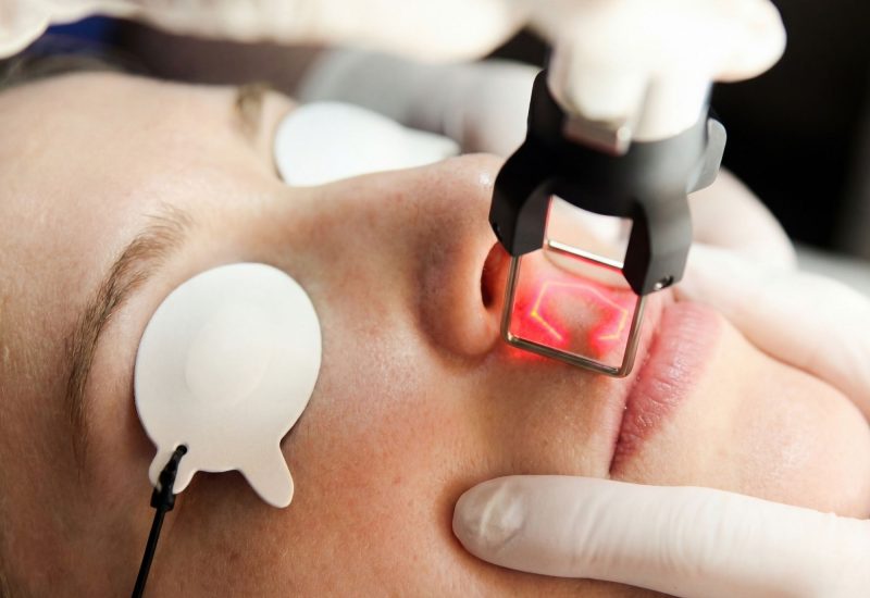 CoolPeel