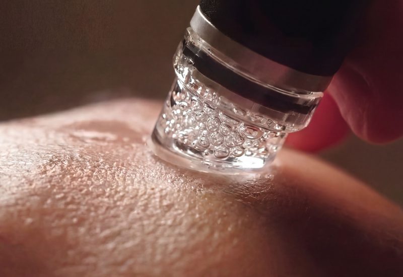 HydroFacial Syndeo