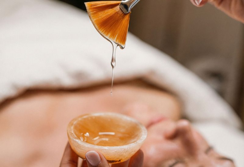 Chemical-Peels-2.jpg
