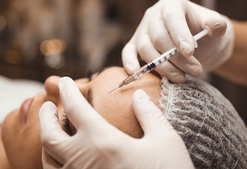 Sculptra treatment