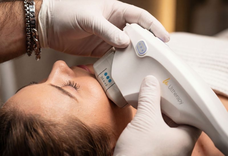 TLLS DT Naples Ultherapy Micro-Focused Ultrasound